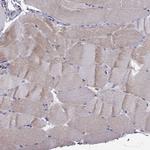 RTDR1 Antibody in Immunohistochemistry (Paraffin) (IHC (P))