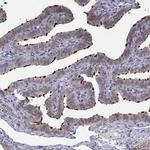 RTDR1 Antibody in Immunohistochemistry (IHC)