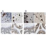 G3BP2 Antibody in Immunohistochemistry (IHC)