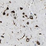 G3BP2 Antibody in Immunohistochemistry (IHC)