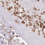 PAPPA2 Polyclonal Antibody