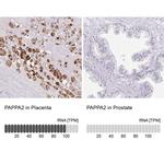 PAPPA2 Antibody in Immunohistochemistry (IHC)