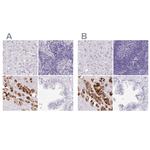 PAPPA2 Antibody in Immunohistochemistry (IHC)