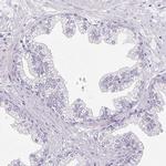 PAPPA2 Antibody in Immunohistochemistry (IHC)