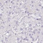 PAPPA2 Antibody in Immunohistochemistry (IHC)