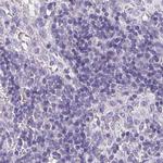 PAPPA2 Antibody in Immunohistochemistry (IHC)