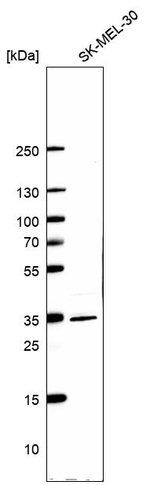 CBR3 Antibody in Western Blot (WB)