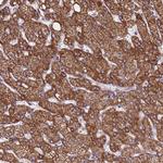 ZNF248 Antibody in Immunohistochemistry (Paraffin) (IHC (P))