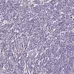 ZNF248 Polyclonal Antibody