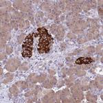 ZNF248 Antibody in Immunohistochemistry (Paraffin) (IHC (P))