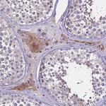 ZNF248 Antibody in Immunohistochemistry (Paraffin) (IHC (P))