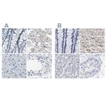 XIRP1 Polyclonal Antibody