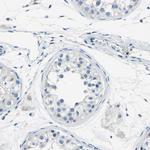 XIRP1 Antibody in Immunohistochemistry (IHC)