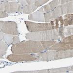 XIRP1 Antibody in Immunohistochemistry (IHC)