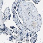 XIRP1 Antibody in Immunohistochemistry (IHC)