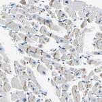 XIRP1 Antibody in Immunohistochemistry (IHC)