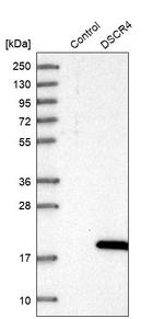 DSCR4 Antibody in Western Blot (WB)