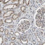 TMEM38B Polyclonal Antibody