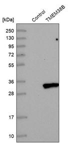 TMEM38B Antibody in Western Blot (WB)