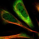 PDCL3 Polyclonal Antibody