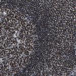 LUC7L3 Antibody in Immunohistochemistry (IHC)