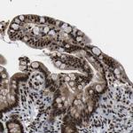 LUC7L3 Antibody in Immunohistochemistry (IHC)