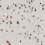 LUC7L3 Antibody in Immunohistochemistry (IHC)