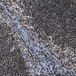 LUC7L3 Antibody in Immunohistochemistry (IHC)