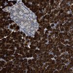 Adenylate Kinase 2 Polyclonal Antibody