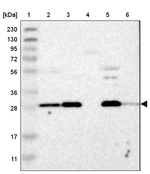Adenylate Kinase 2 Antibody in Western Blot (WB)