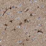 Septin 2 Antibody in Immunohistochemistry (Paraffin) (IHC (P))