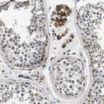 PDP1 Antibody in Immunohistochemistry (Paraffin) (IHC (P))
