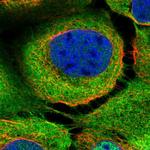 BAG3 Polyclonal Antibody