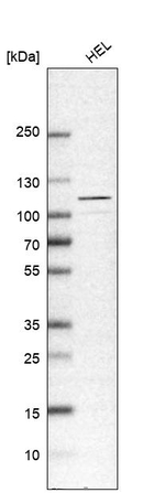 USP4 Antibody in Western Blot (WB)