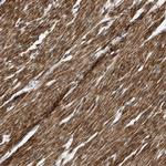 MTMR1 Polyclonal Antibody