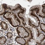 TAIP12 Polyclonal Antibody