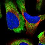 RPS14 Polyclonal Antibody