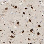 RPS14 Antibody in Immunohistochemistry (Paraffin) (IHC (P))