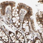 RPS14 Antibody in Immunohistochemistry (Paraffin) (IHC (P))