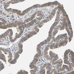 RPS14 Antibody in Immunohistochemistry (Paraffin) (IHC (P))