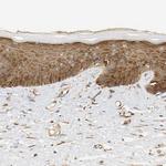 RPS14 Antibody in Immunohistochemistry (Paraffin) (IHC (P))