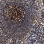 SIT Polyclonal Antibody