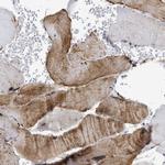 TMED1 Antibody in Immunohistochemistry (Paraffin) (IHC (P))
