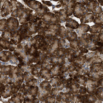TMED1 Antibody in Immunohistochemistry (Paraffin) (IHC (P))