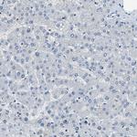 SLC38A6 Antibody in Immunohistochemistry (Paraffin) (IHC (P))