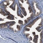 SLC38A6 Antibody in Immunohistochemistry (Paraffin) (IHC (P))