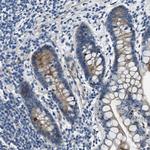 SLC38A6 Antibody in Immunohistochemistry (Paraffin) (IHC (P))