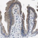 SLC38A6 Antibody in Immunohistochemistry (IHC)