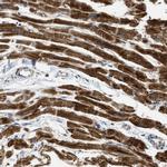 KNP-I Antibody in Immunohistochemistry (Paraffin) (IHC (P))