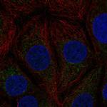 KNP-I Polyclonal Antibody